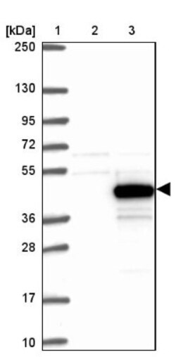 KLHDC9 Antibody, Novus Biologicals 0.1mL; Unlabeled:Antibodies, Polyclonal